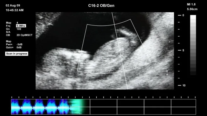 抖音快手无人直播胎教助眠全攻略：含教程、软件与素材