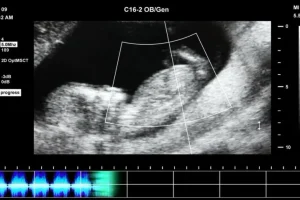 抖音快手无人直播胎教助眠全攻略：含教程、软件与素材