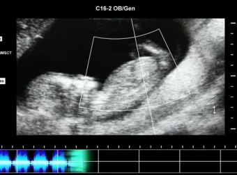 抖音快手无人直播胎教助眠全攻略：含教程、软件与素材
